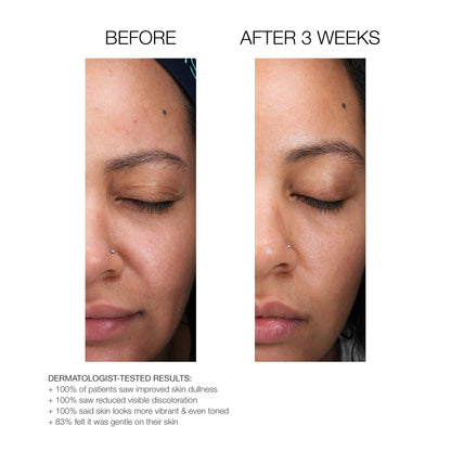 SmoothRenew Resurfacing Serum (large) 1 oz